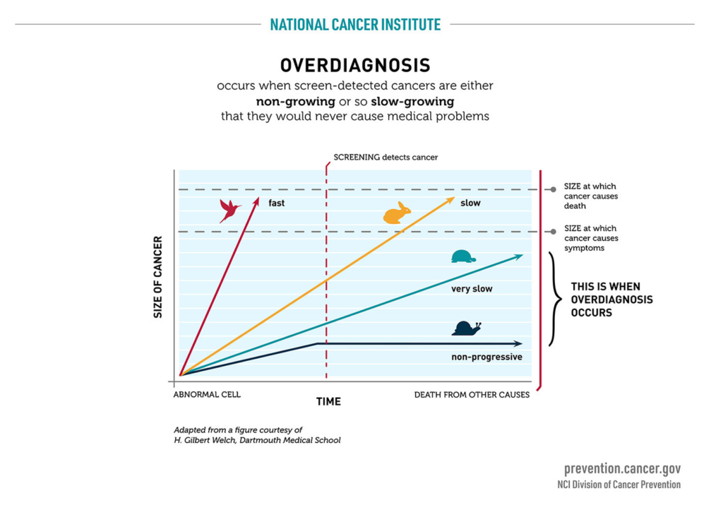 Infographie du national cancer institute sur le surdiagnostic et les cancer d'intervalle